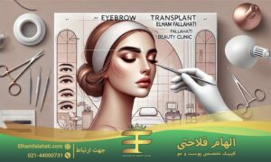 کاشت ابرو در کلینیک زیبایی الهام فلاحتی چگونه انجام می شود؟